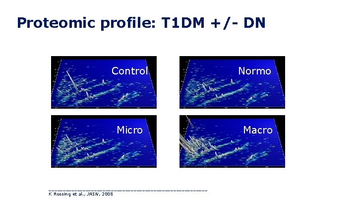 21 Proteomic profile: T 1 DM +/ DN Control Micro ____________________________ K Rossing et