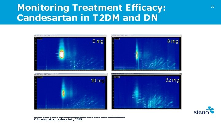 Monitoring Treatment Efficacy: Candesartan in T 2 DM and DN 22 0 mg 8