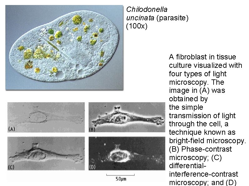 Chilodonella uncinata (parasite) (100 x) A fibroblast in tissue culture visualized with four types