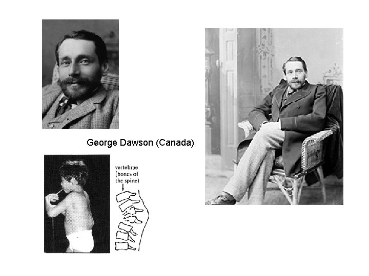 George Dawson (Canada) 