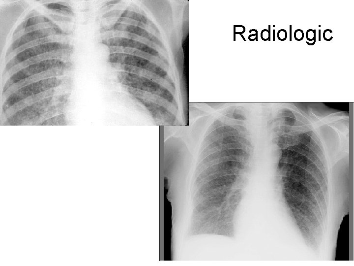 Radiologic 