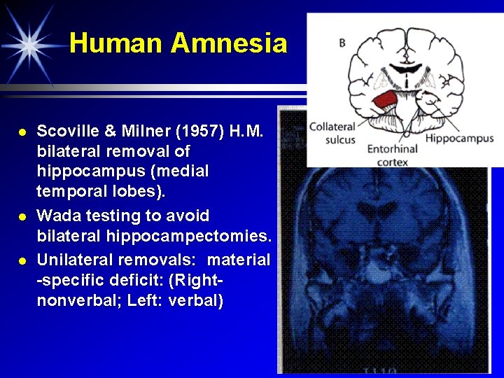 Human Amnesia Scoville & Milner (1957) H. M. bilateral removal of hippocampus (medial temporal