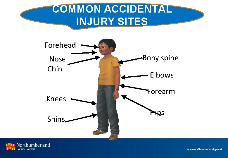 COMMON ACCIDENTAL INJURY SITES Forehead Nose Chin Knees Shins Bony spine Elbows Forearm Hips