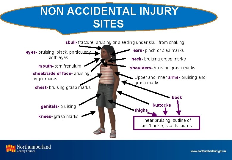 NON ACCIDENTAL INJURY SITES skull- fracture, bruising or bleeding under skull from shaking eyes-