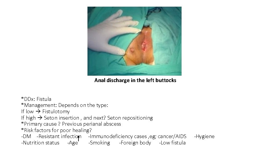 Anal discharge in the left buttocks *DDx: Fistula *Management: Depends on the type: If