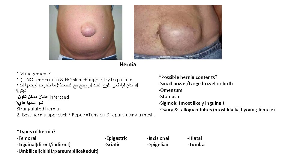 Hernia *Management? 1. (If NO tenderness & NO skin changes: Try to push in.