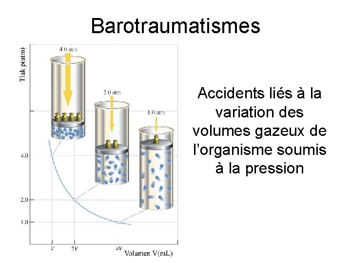 Barotraumatismes Accidents liés à la variation des volumes gazeux de l’organisme soumis à la
