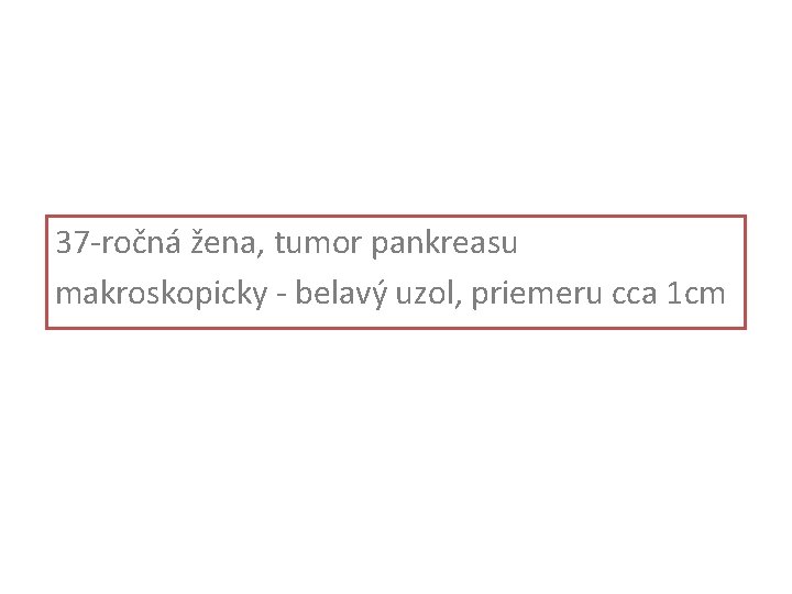 37 -ročná žena, tumor pankreasu makroskopicky - belavý uzol, priemeru cca 1 cm 