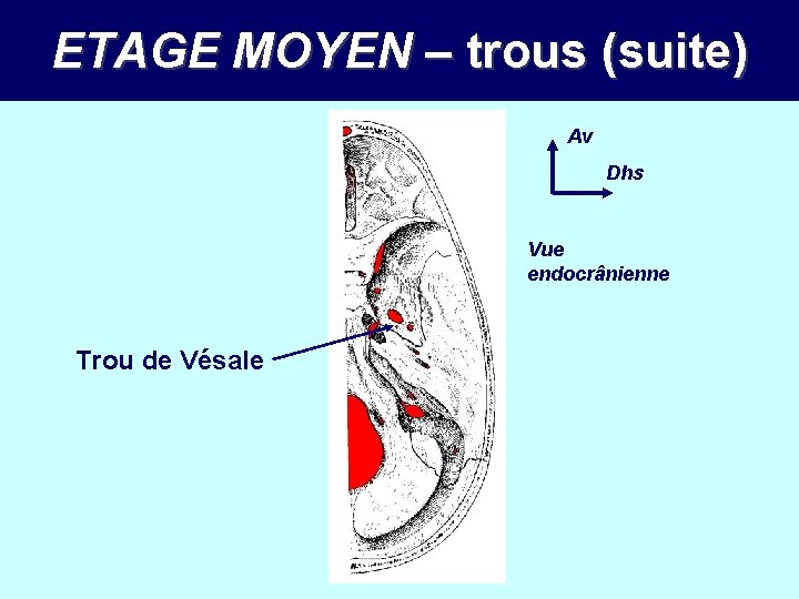ETAGE MOYEN – trous (suite) Av Dhs Vue endocrânienne Trou de Vésale 