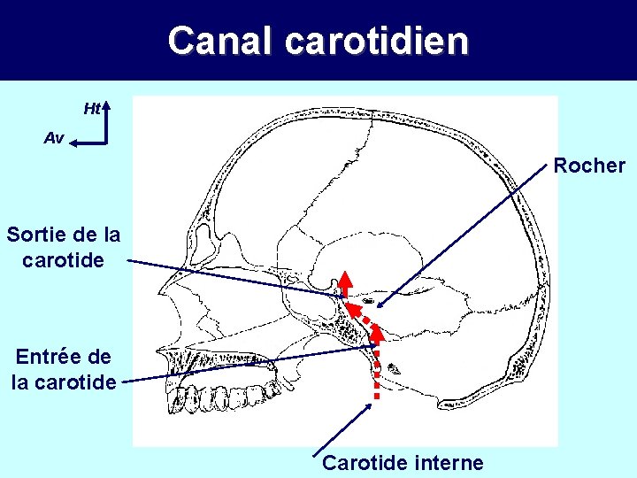 Canal carotidien Ht Av Rocher Sortie de la carotide Entrée de la carotide Carotide