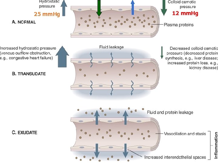 25 mm. Hg 32 mm. Hg 12 mm. Hg 