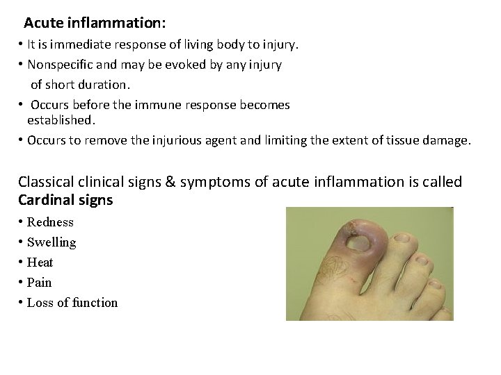 Acute inflammation: • It is immediate response of living body to injury. • Nonspecific