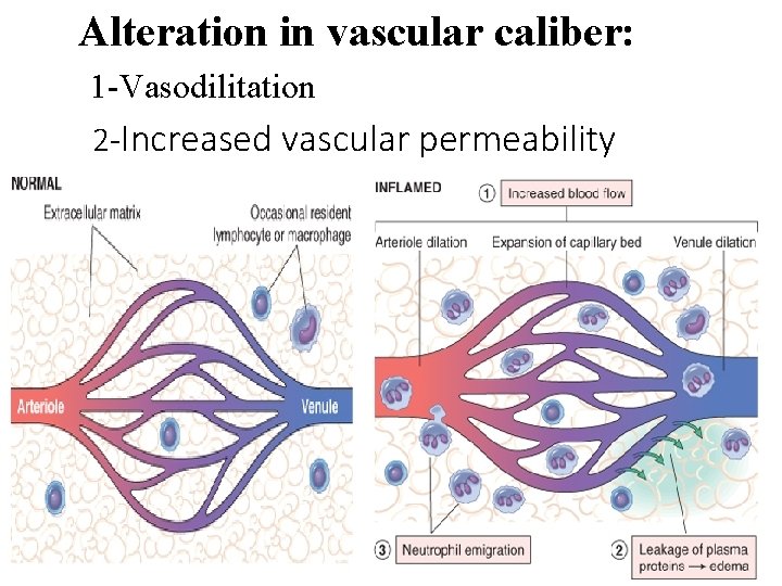 Alteration in vascular caliber: 1 -Vasodilitation 2 -Increased vascular permeability 
