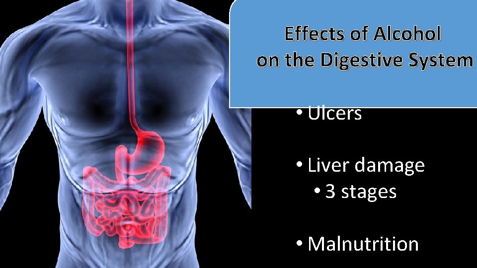 Effects of Alcohol on the Digestive System • Ulcers • Liver damage • 3