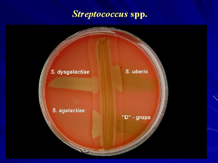 Streptococcus spp. 