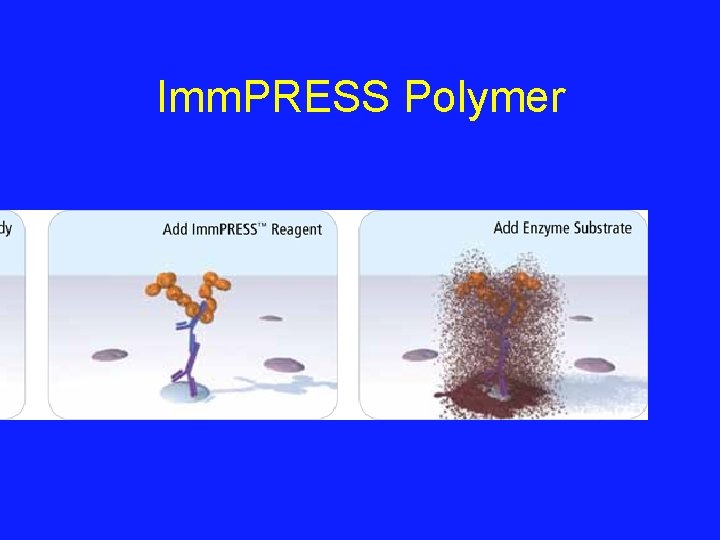Imm. PRESS Polymer 
