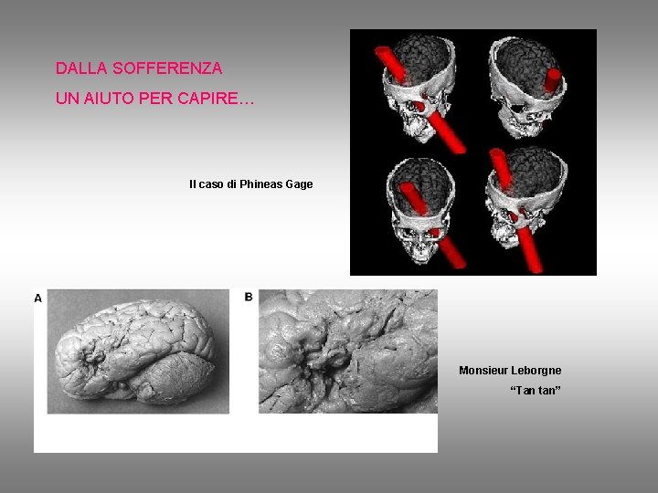DALLA SOFFERENZA UN AIUTO PER CAPIRE… Il caso di Phineas Gage Monsieur Leborgne “Tan