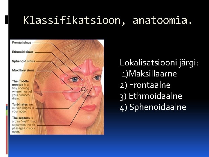 Klassifikatsioon, anatoomia. Lokalisatsiooni järgi: 1)Maksillaarne 2) Frontaalne 3) Ethmoidaalne 4) Sphenoidaalne 