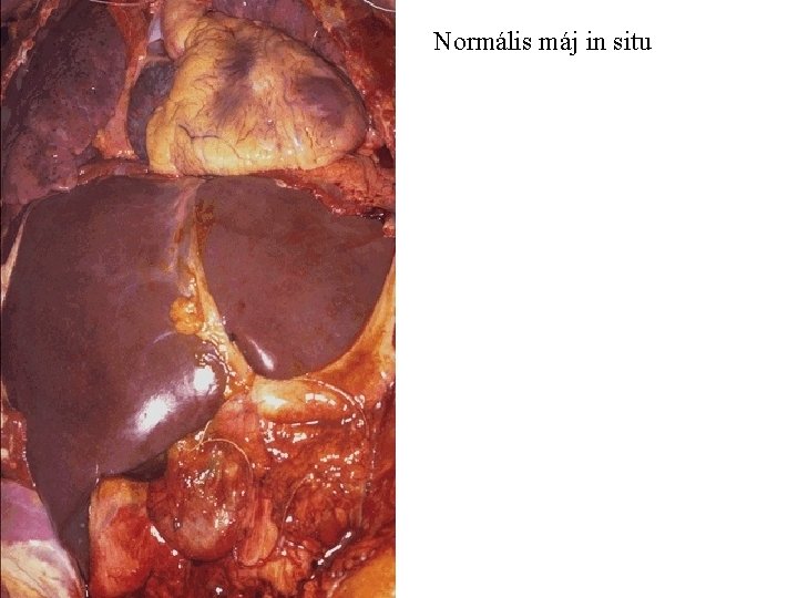 Normális máj in situ 