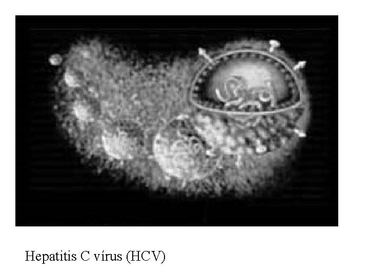 Hepatitis C vírus (HCV) 