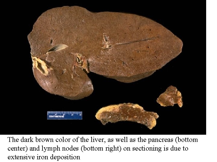 The dark brown color of the liver, as well as the pancreas (bottom center)