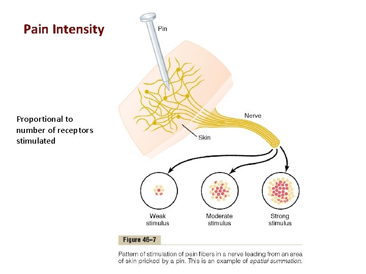 Pain Intensity Proportional to number of receptors stimulated 