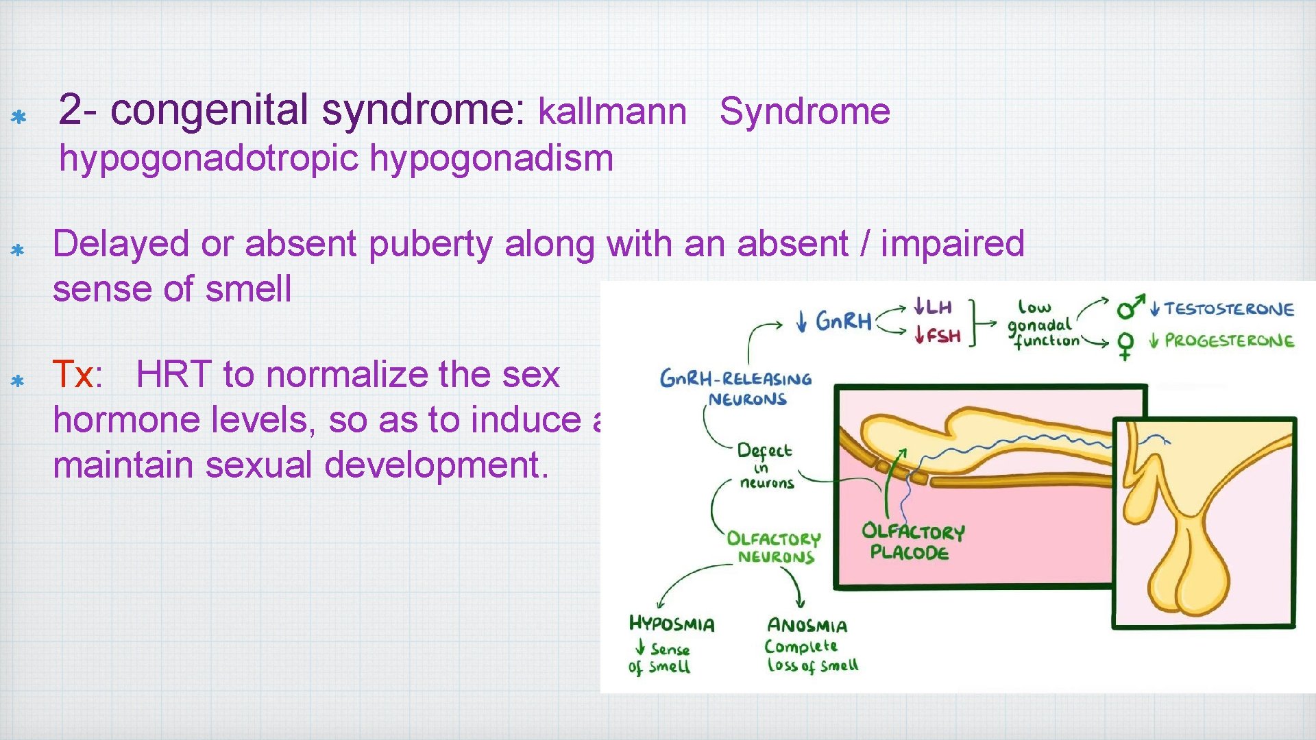 2 - congenital syndrome: kallmann Syndrome hypogonadotropic hypogonadism Delayed or absent puberty along with