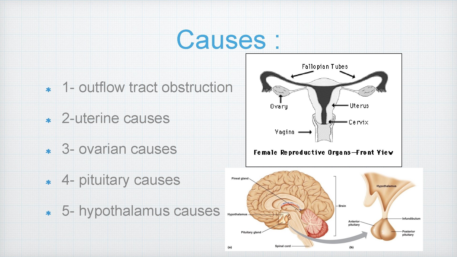 Causes : 1 - outflow tract obstruction 2 -uterine causes 3 - ovarian causes