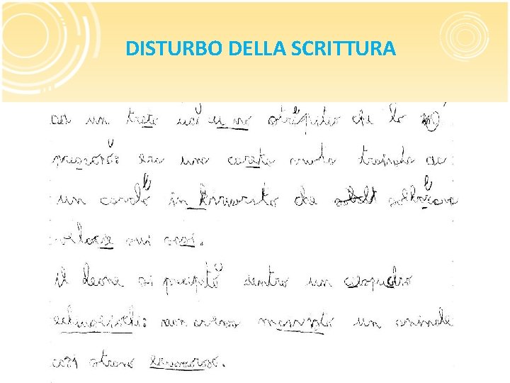 DISTURBO DELLA SCRITTURA 