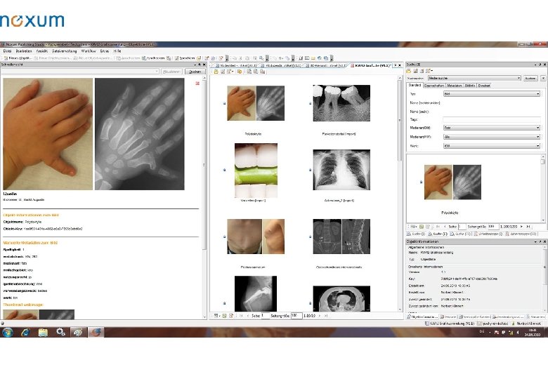 CMS: Beispielscreenshots Rich. Client 
