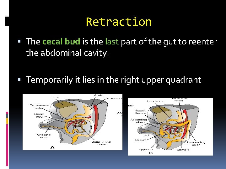 Retraction The cecal bud is the last part of the gut to reenter the