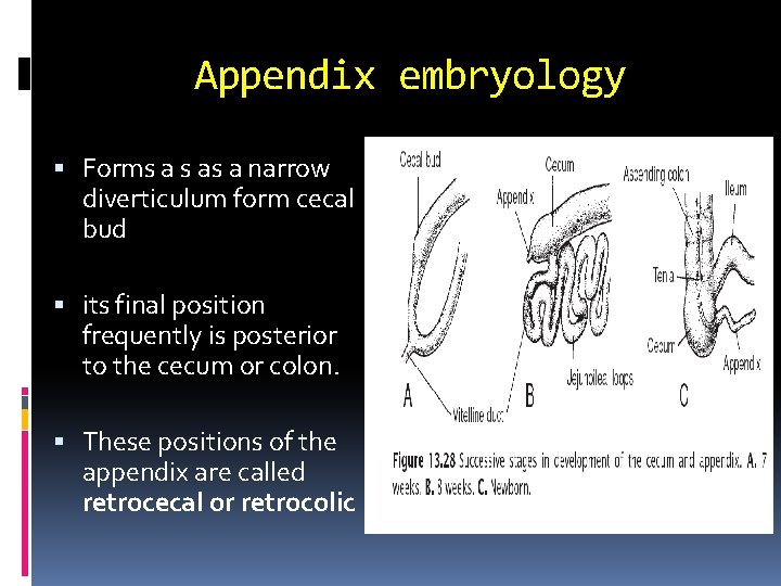 Appendix embryology Forms a s as a narrow diverticulum form cecal bud its final