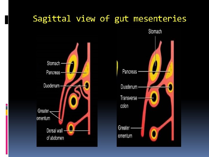 Sagittal view of gut mesenteries 