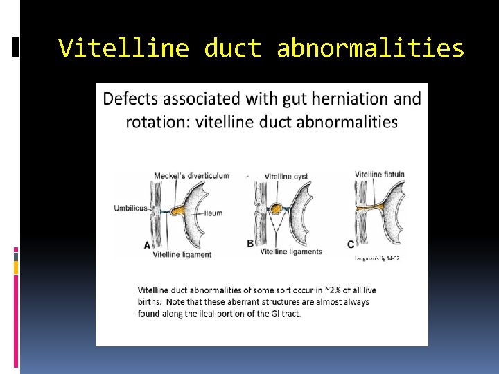 Vitelline duct abnormalities 