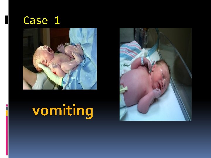 Case 1 vomiting 
