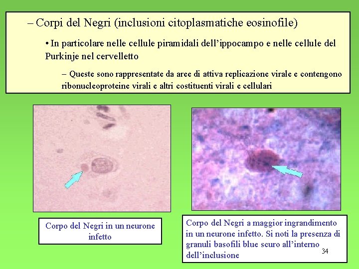 – Corpi del Negri (inclusioni citoplasmatiche eosinofile) • In particolare nelle cellule piramidali dell’ippocampo