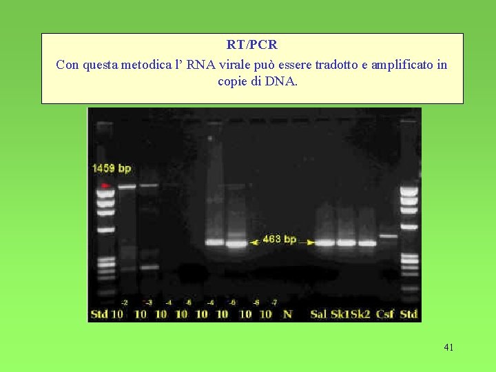 RT/PCR Con questa metodica l’ RNA virale può essere tradotto e amplificato in copie