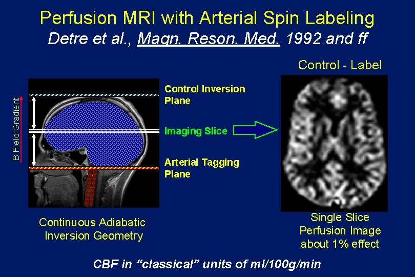Perfusion MRI with Arterial Spin Labeling Detre et al. , Magn. Reson. Med. 1992