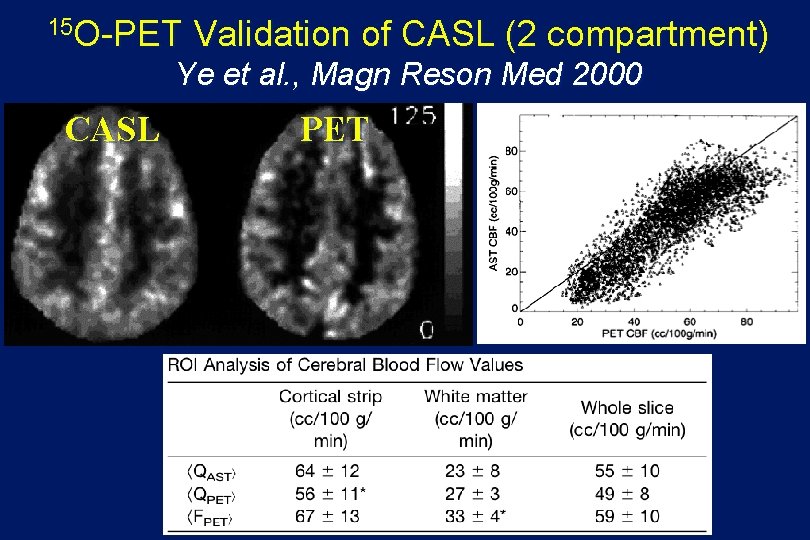 15 O-PET Validation of CASL (2 compartment) Ye et al. , Magn Reson Med
