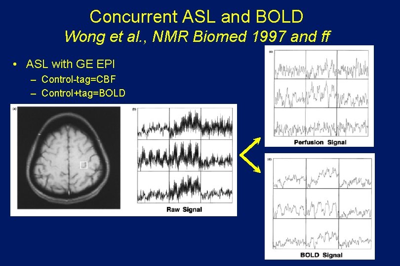 Concurrent ASL and BOLD Wong et al. , NMR Biomed 1997 and ff •
