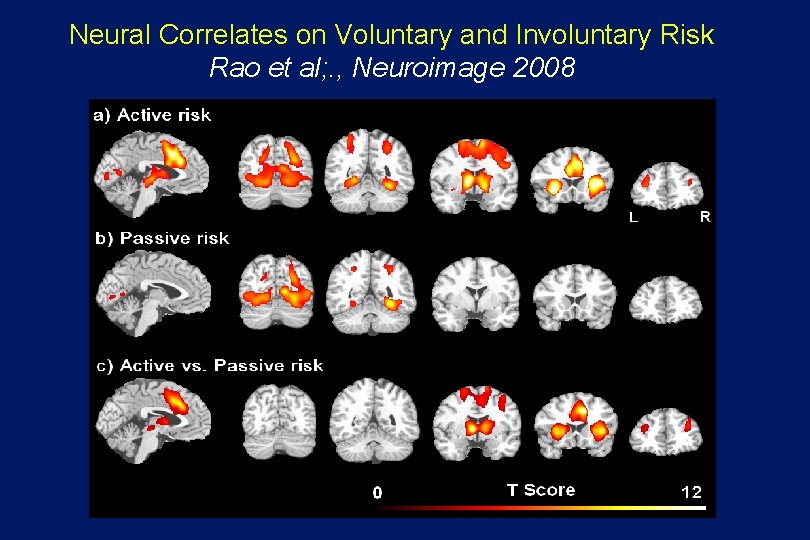 Neural Correlates on Voluntary and Involuntary Risk Rao et al; . , Neuroimage 2008