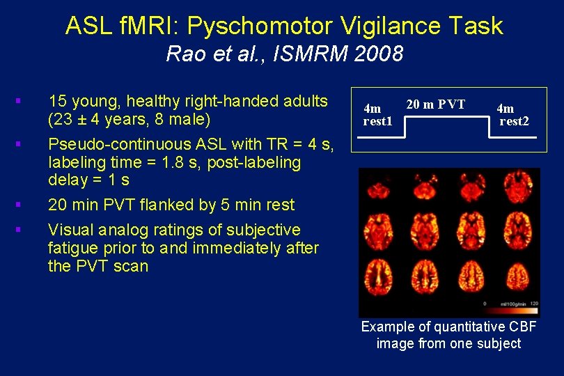 ASL f. MRI: Pyschomotor Vigilance Task Rao et al. , ISMRM 2008 § §