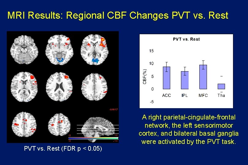 MRI Results: Regional CBF Changes PVT vs. Rest (FDR p < 0. 05) A
