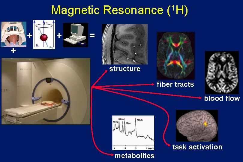 Magnetic Resonance (1 H) + + = + structure fiber tracts blood flow task