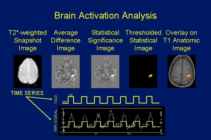 Brain Activation Analysis f. MRI SIGNAL TIME SERIES TASK T 2*-weighted Average Snapshot Difference