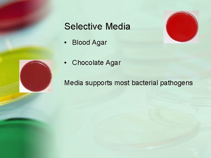 Selective Media • Blood Agar • Chocolate Agar Media supports most bacterial pathogens 