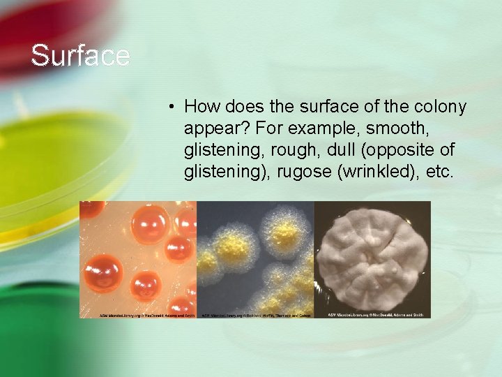 Surface • How does the surface of the colony appear? For example, smooth, glistening,