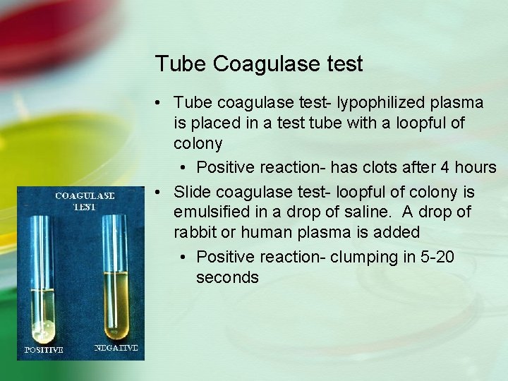 Tube Coagulase test • Tube coagulase test- lypophilized plasma is placed in a test