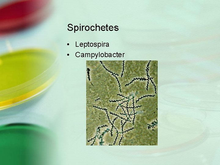 Spirochetes • Leptospira • Campylobacter 