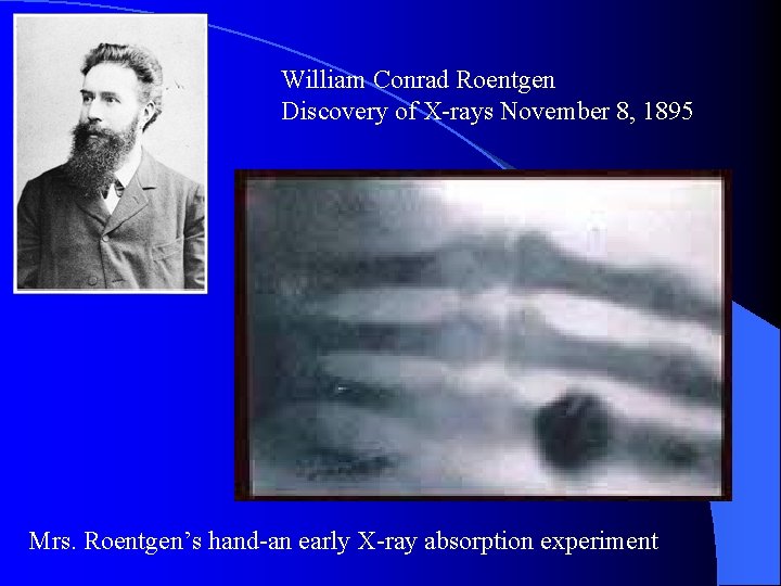 William Conrad Roentgen Discovery of X-rays November 8, 1895 Mrs. Roentgen’s hand-an early X-ray